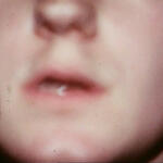 Names Of Friends: Poem for the Deaf-Mute